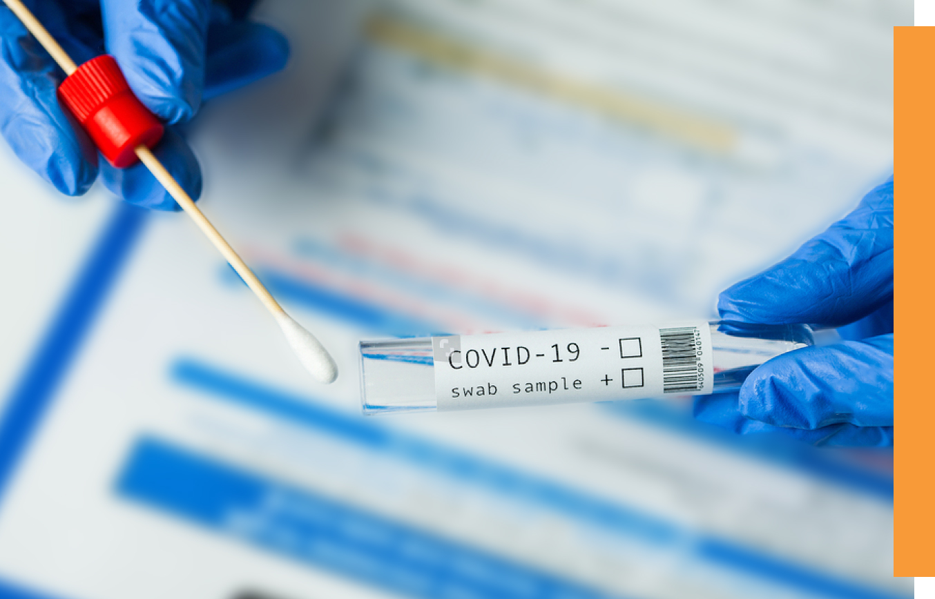 Two types of tests diagnostic tests and antibody tests